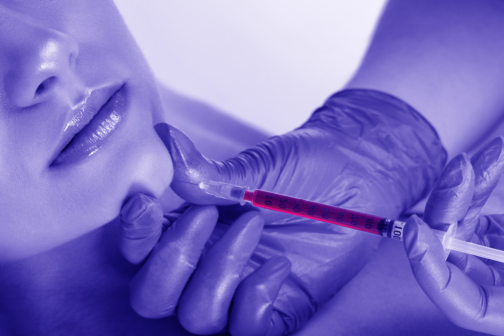 Rojstno dnevno darilo je lahko tudi   facelift, ki povrne mladosten videz